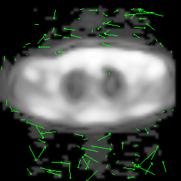 MRI Optical Flow GIF