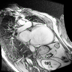 Cardiac Imaging